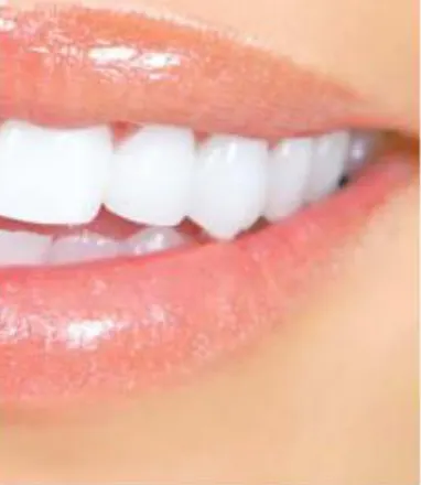 Clareamento Dental