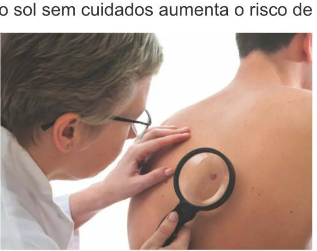 O perigo do câncer de pele