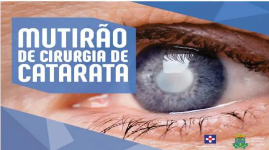 Mutirão de Cirurgias